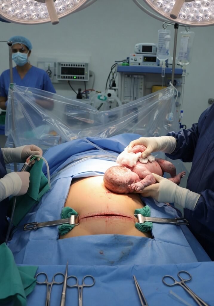 C-Section: What to Expect Before During and After