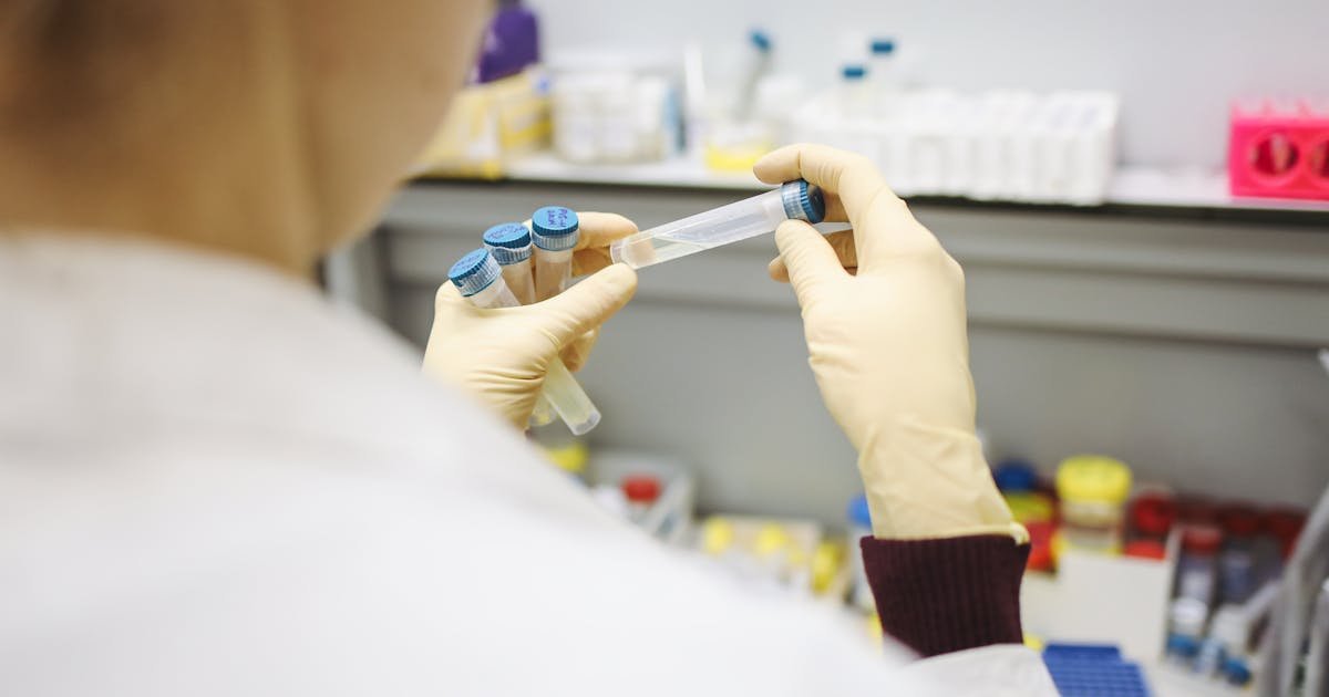 Thyroid Function Tests: TSH T3 T4 Explained