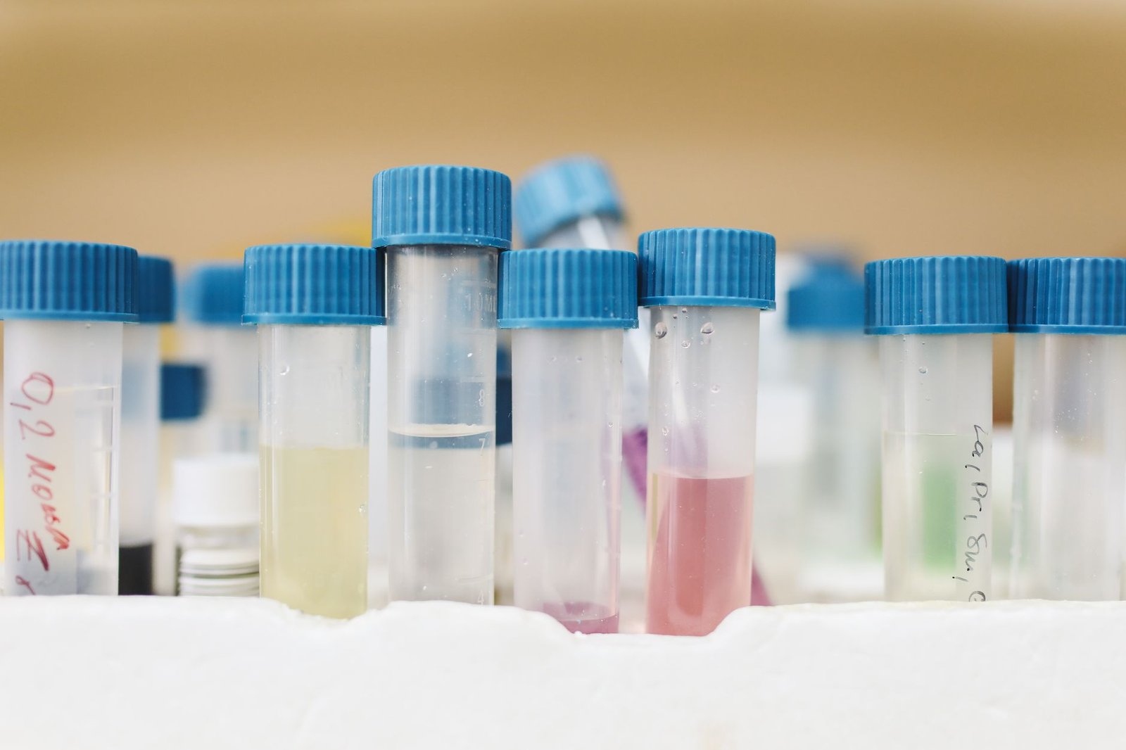 New Research: Common plastic chemical linked to lifelong anxiety in new study