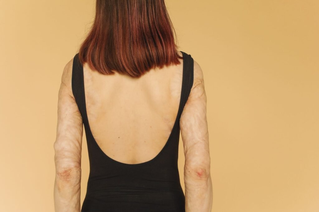Wellness Report: These fat-filled brain cells may be making multiple sclerosis worse