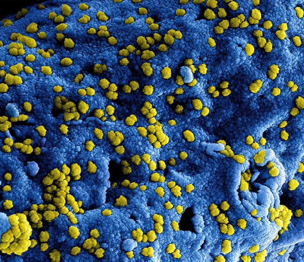 The Truth About Antiviral Stop Measles Before That Big Pharma Doesn’t Want You to Know