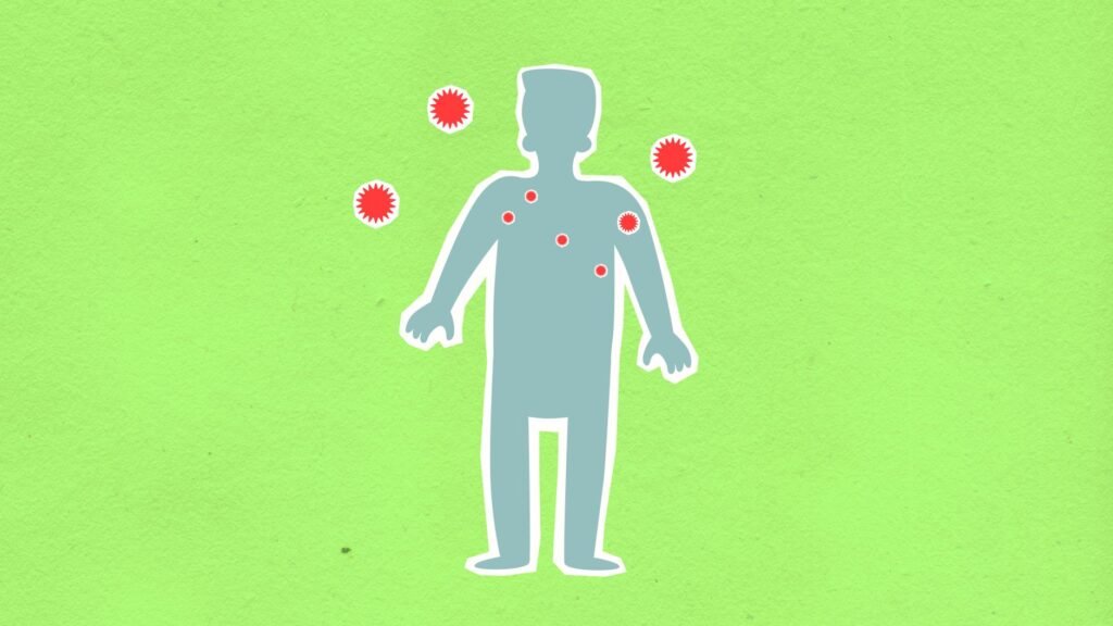 Crohns Disease