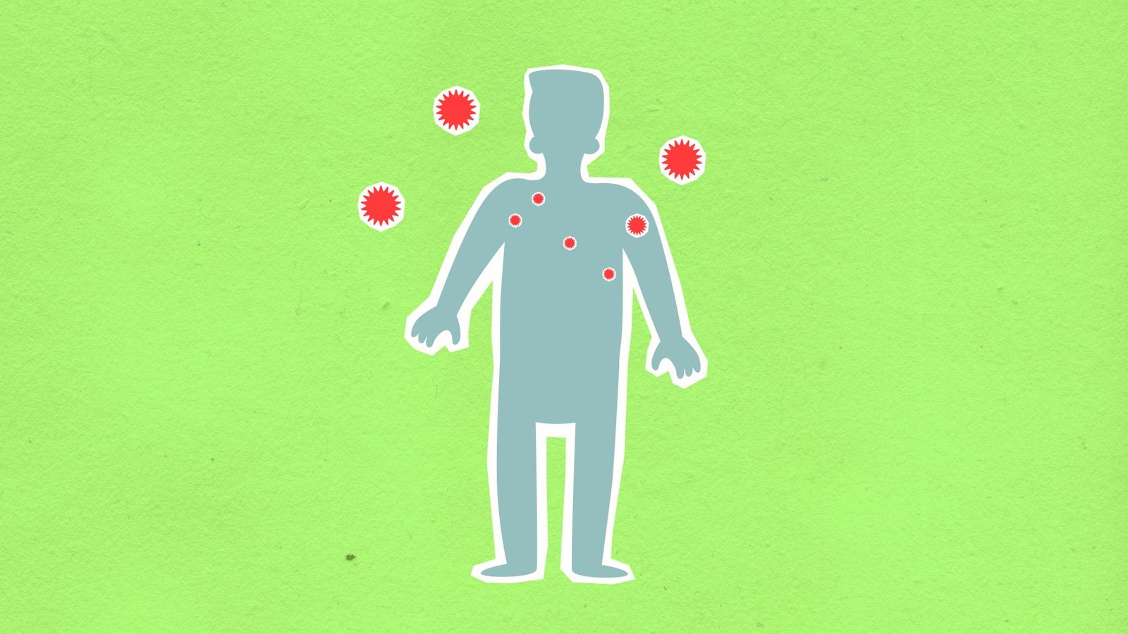 Crohns Disease