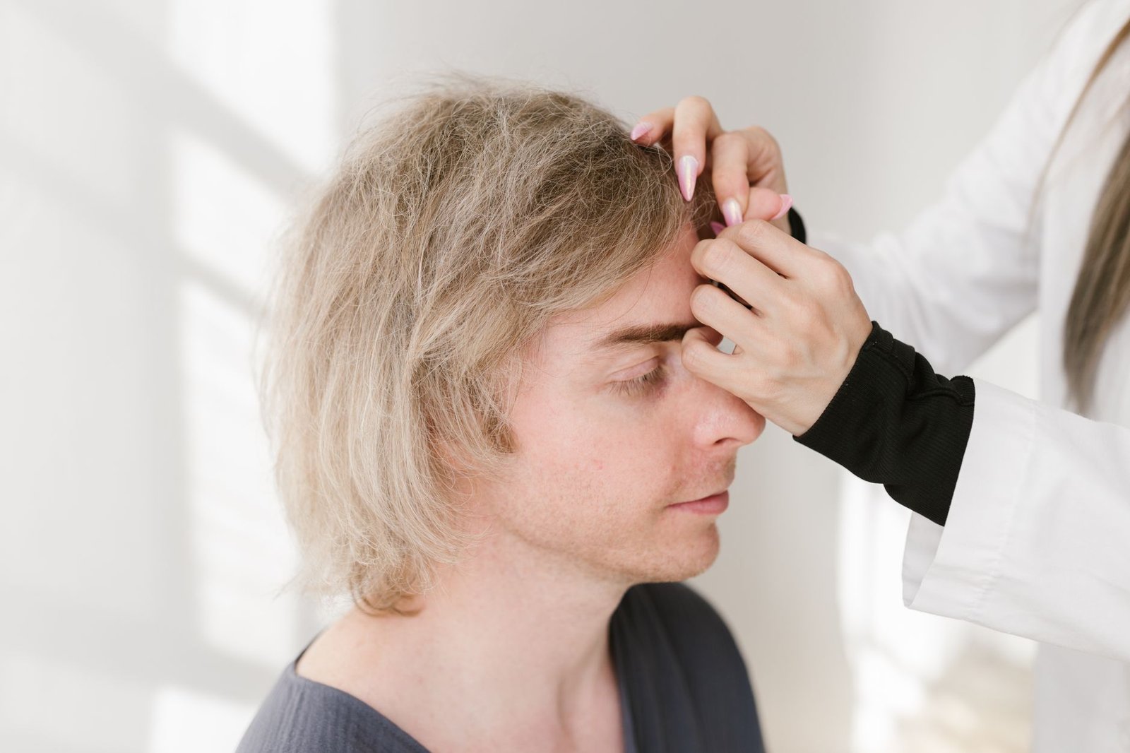 Male Hair Loss