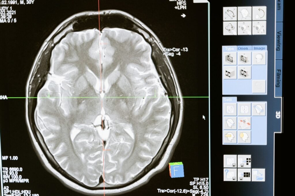 Medical Breakthrough: New Alzheimer's drug repairs DNA damage and reduces brain inflammation