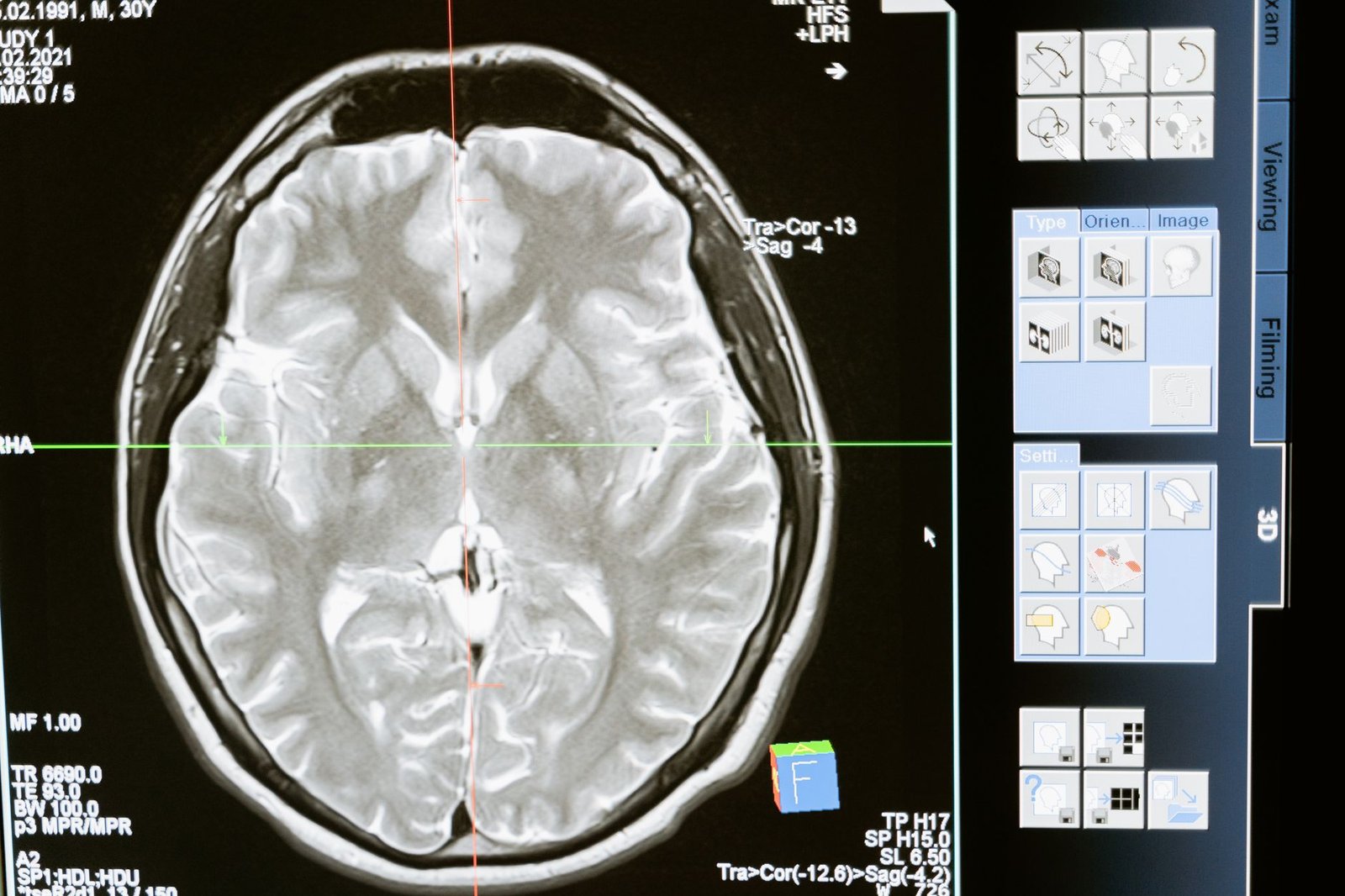 Medical Breakthrough: New Alzheimer's drug repairs DNA damage and reduces brain inflammation