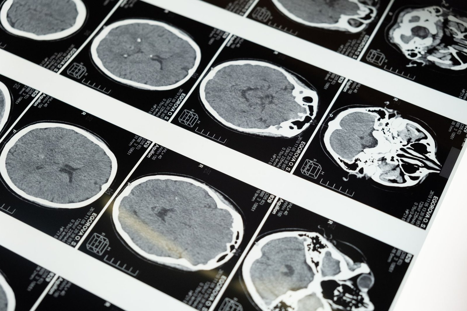 The #1 Food Keeping You Sick (And You Eat It Every Day)
