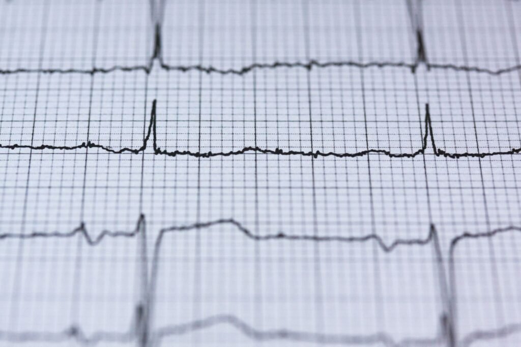 Your Heart Is Sending You Warning Signals — Are You Missing Them?