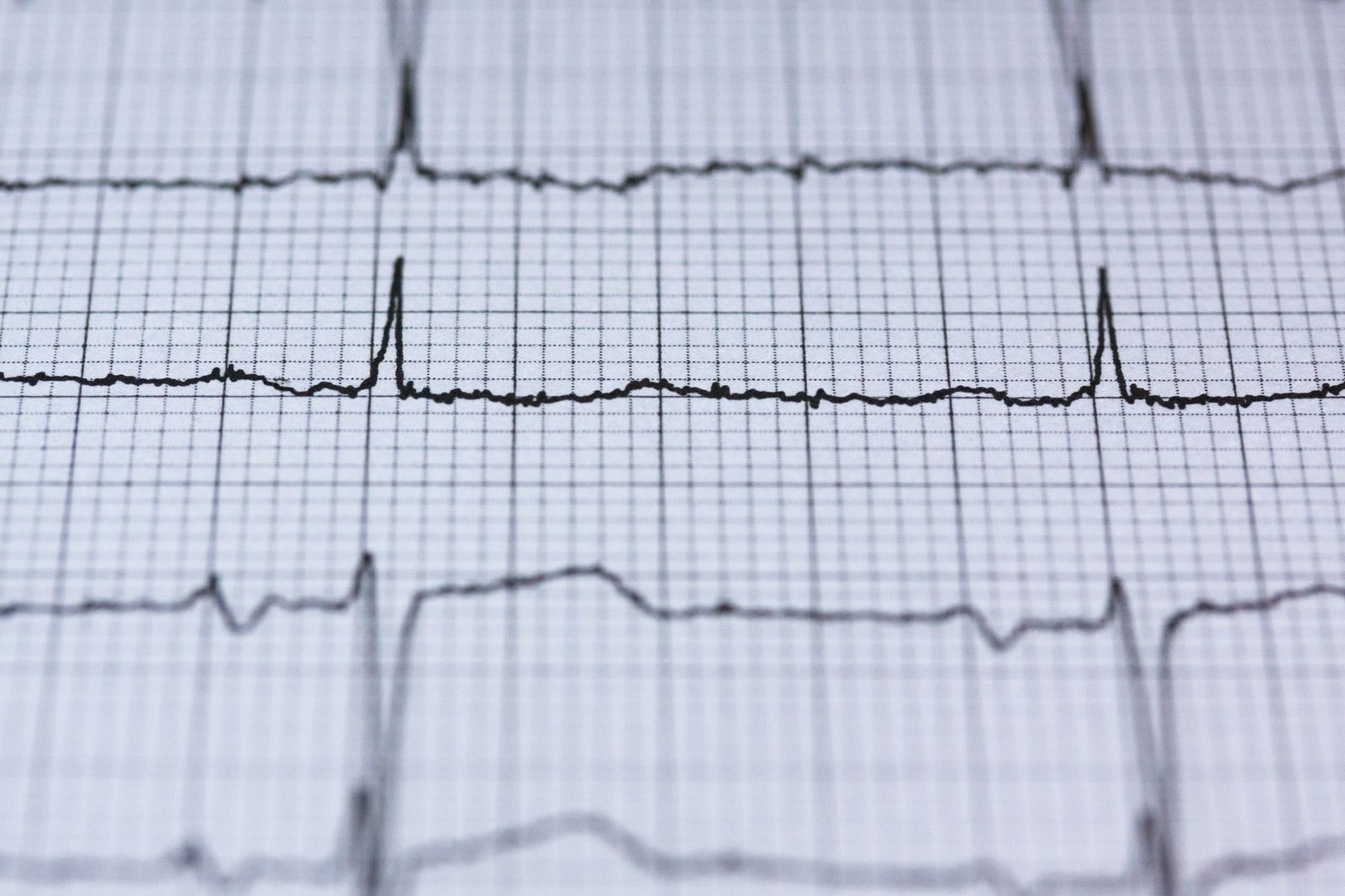 Your Heart Is Sending You Warning Signals — Are You Missing Them?