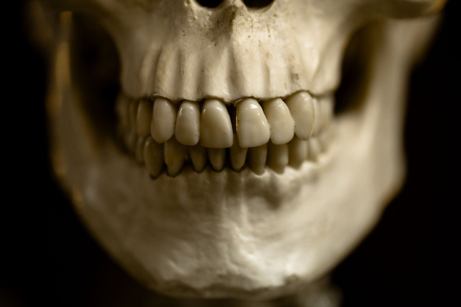 Bone Density Test