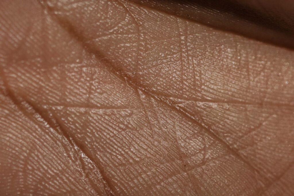 Dry Skin Relief