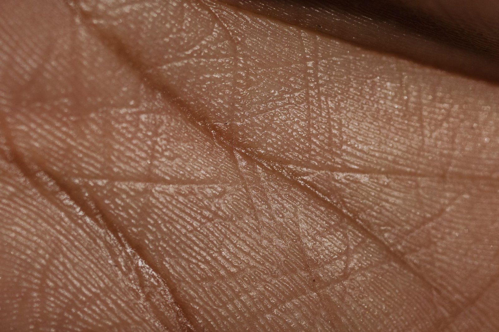 Dry Skin Relief