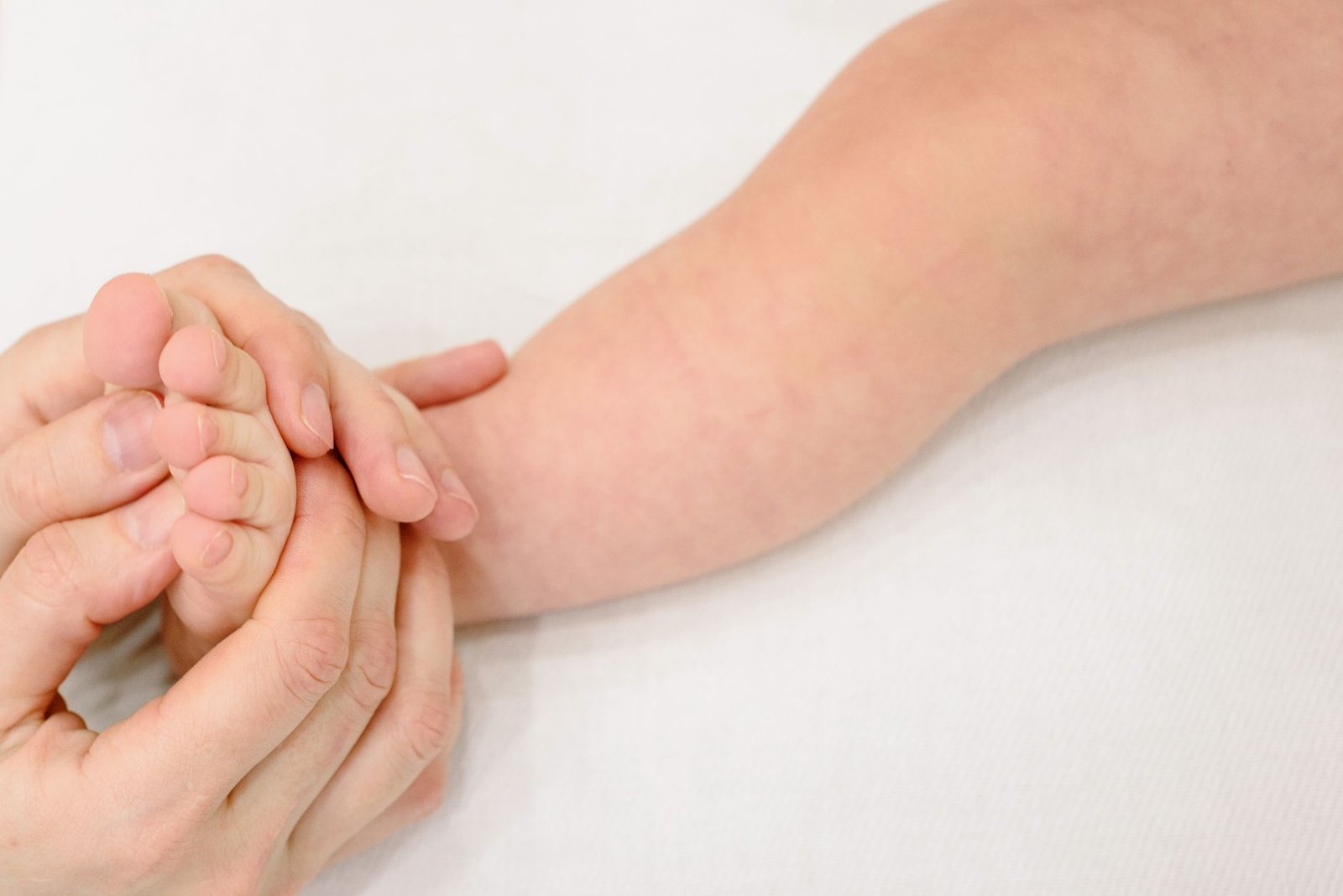 Eczema Treatment