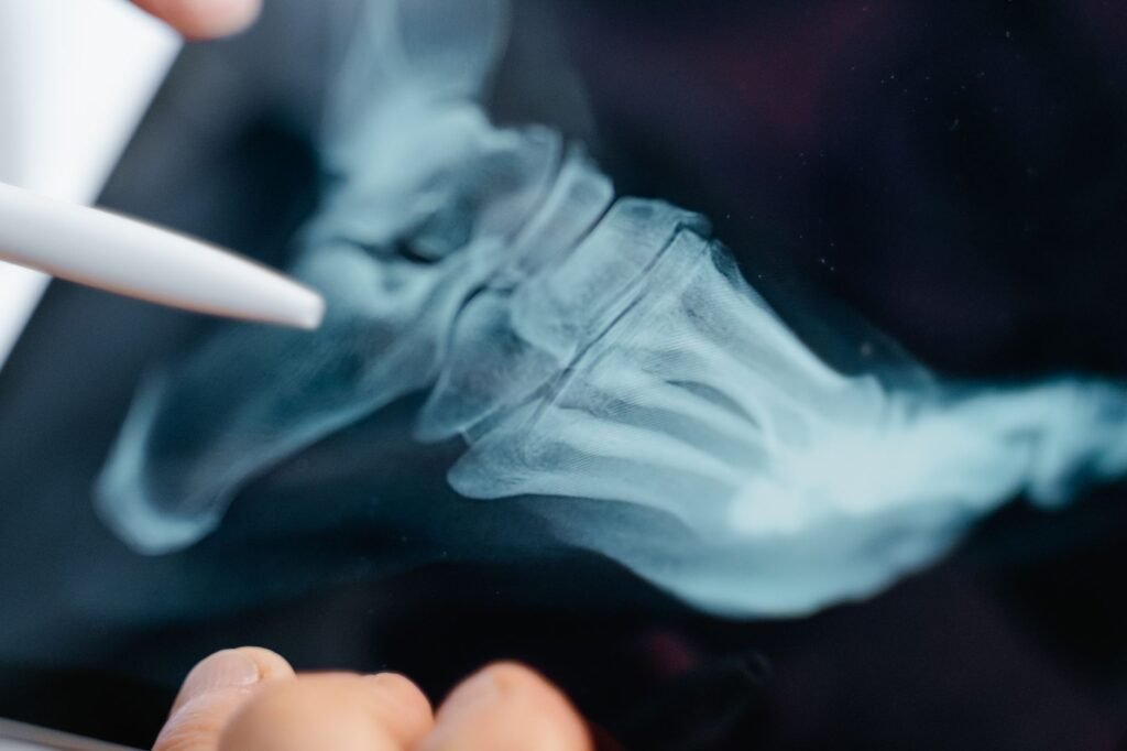 Doctors Are Stunned: Scientists turn sheep’s wool into a material that helps regrow bone