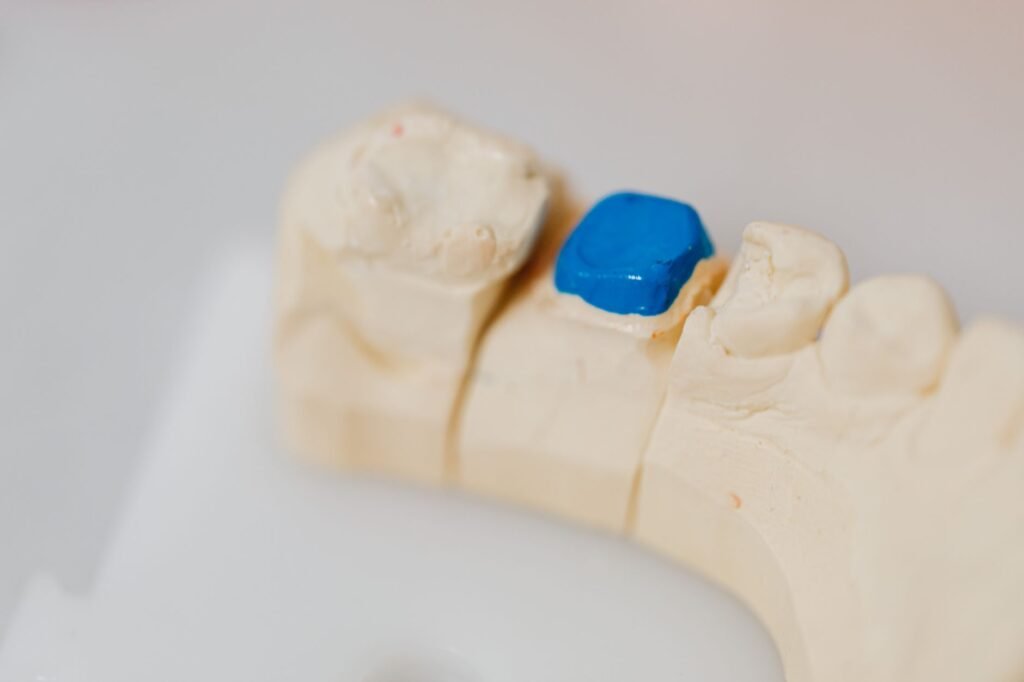 Warning: The dental crown of the future could be 3D-printed while you wait