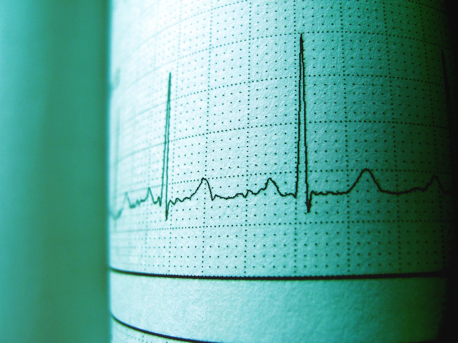 Your Heart Is Sending You Warning Signals — Are You Missing Them?