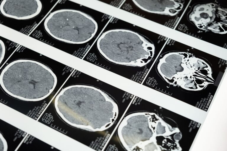 What Happens to Your Body When You Stop Eating Injectable Treatment Helps Brain