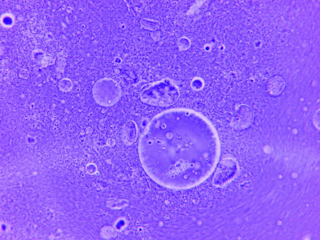 This Changes Everything: Scientists discover a surprising paradox in how our cells age