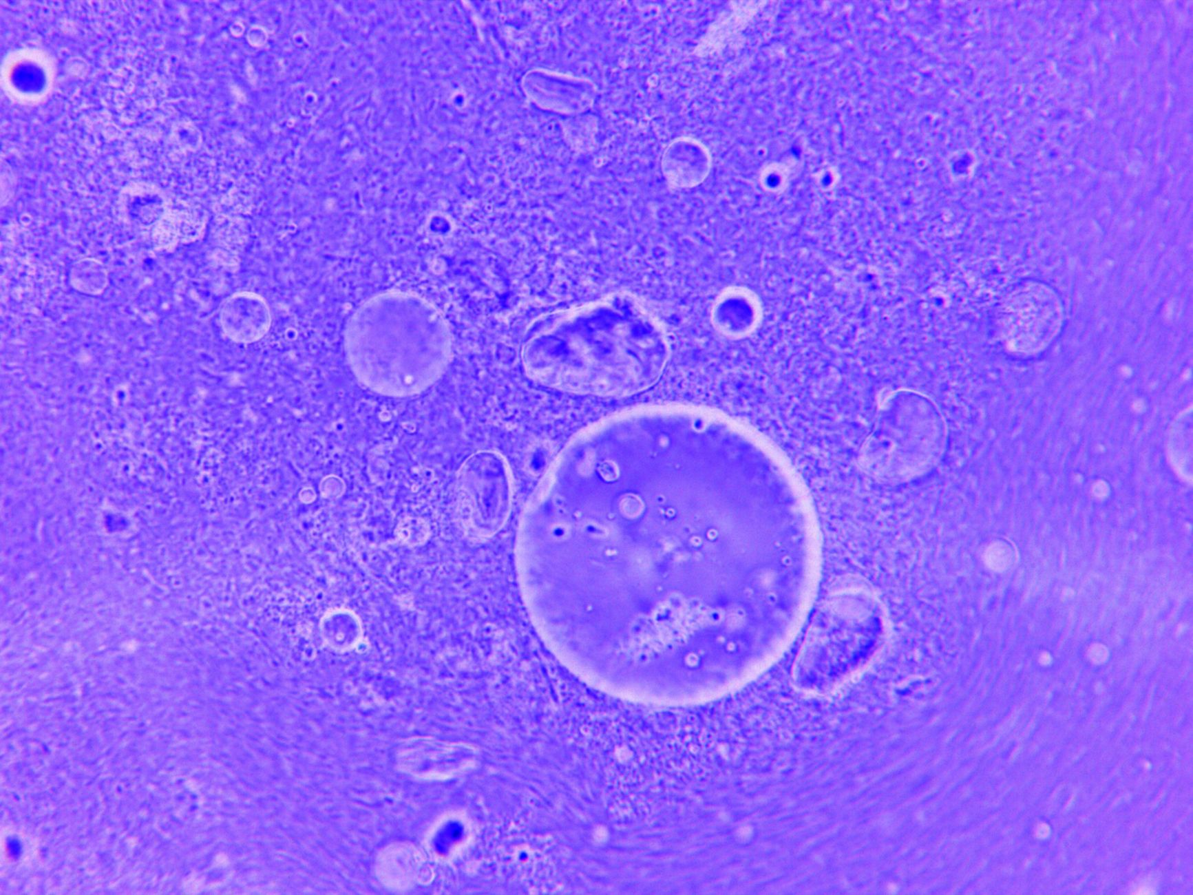This Changes Everything: Scientists discover a surprising paradox in how our cells age