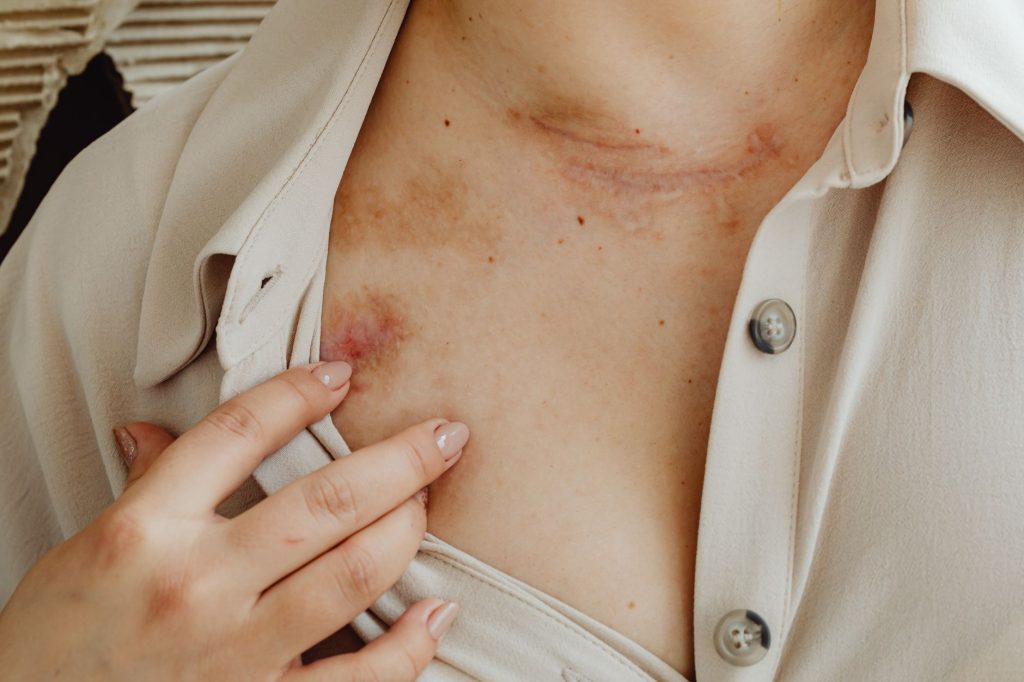 The Truth About Found Diabetic Wounds Refuse That Big Pharma Doesn’t Want You to Know