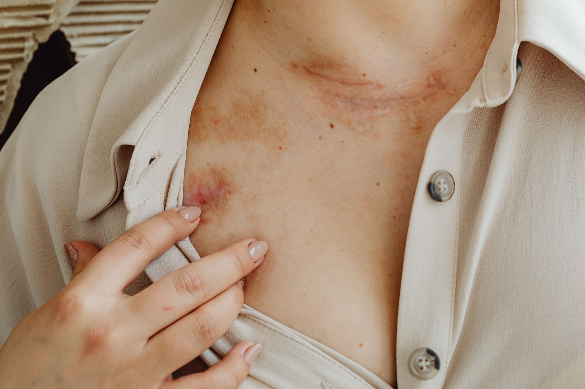 The Truth About Found Diabetic Wounds Refuse That Big Pharma Doesn’t Want You to Know